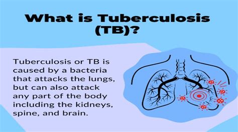 tb causes and symptoms.
